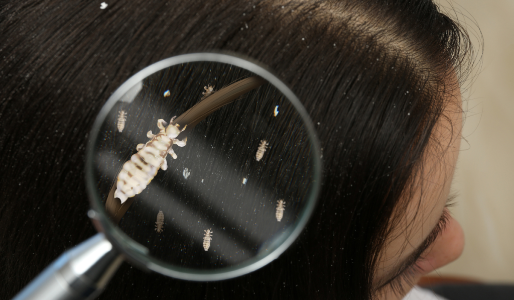 Découvrez a quoi ressemble un poux - centre anti poux à Lyon